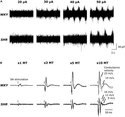 The Pressor Response to Concurrent Stimulation of the Mesencephalic Locomotor Region and Peripheral Sensory Afferents Is Attenuated in Normotensive but Not Hypertensive Rats